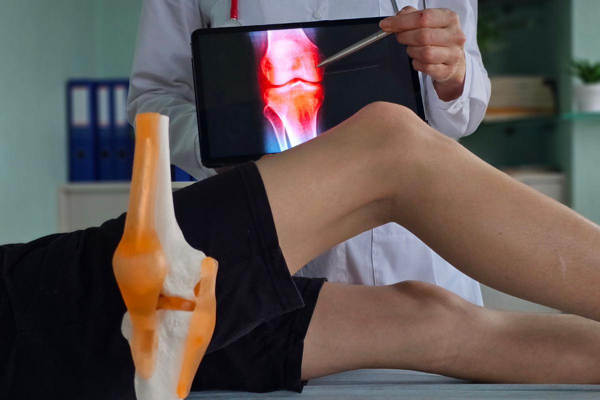 Microfracturas vs Mosaicoplastia vs AMIC: ¿Cuál Técnica Es Mejor para ...